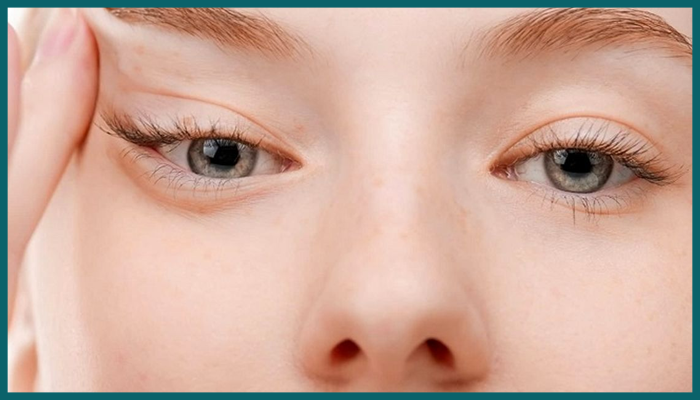 تاثیر لیفت آندوسکوپی پیشانی و شقیقه