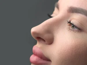 ورم بعد از جراحی بینی