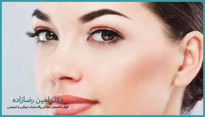 لیفت ابرو با اندوتاین برای چه کسانی مناسب است؟